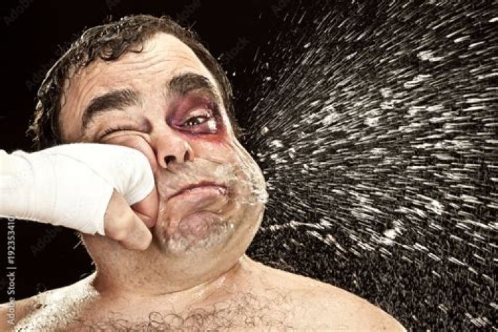 Fat ___ (injury for a boxer)