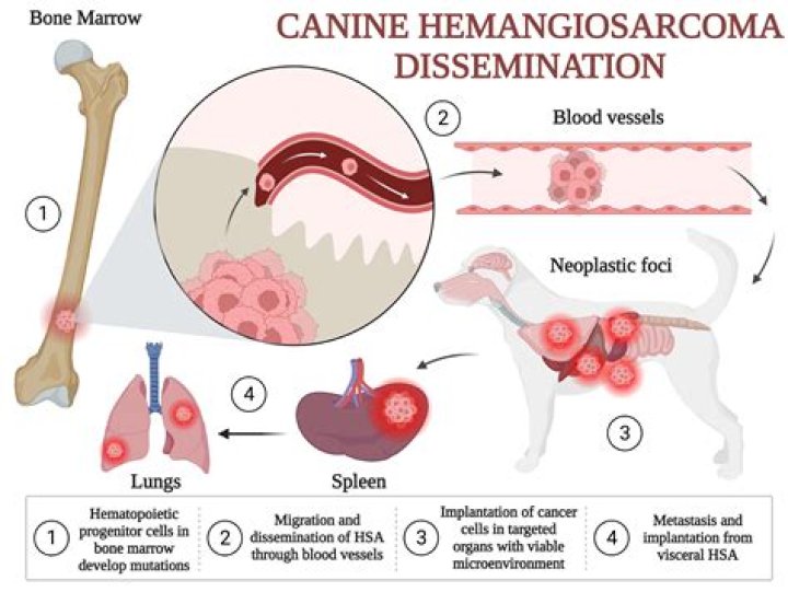 Where does sarcoma spread to first?